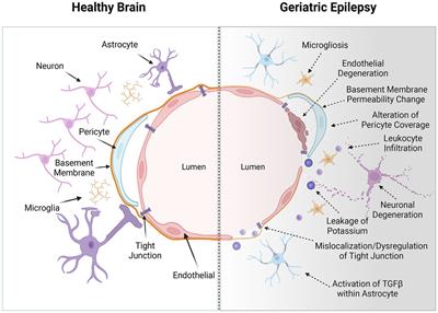 Challenges and prospects in geriatric epilepsy treatment: the role of the blood–brain barrier in pharmacotherapy and drug delivery